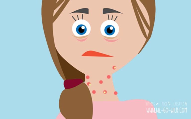 pickel am hals hormone